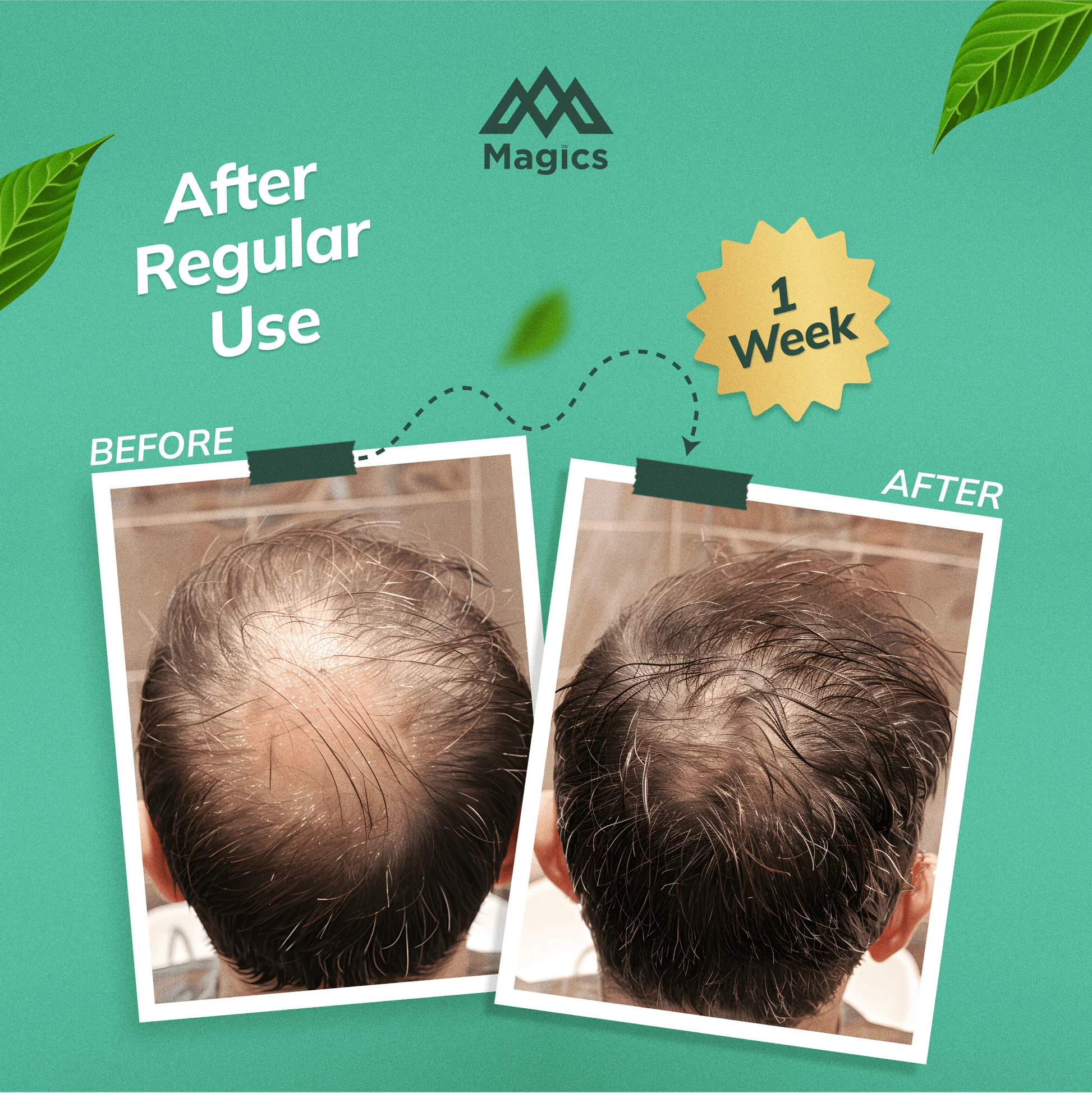 Magics Hair Care - Ayurvedic Shampoo Mix Powder (pack of 1)